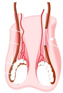 orolog-205x300 Лечение варикоцеле